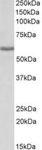 Fibrinogen Beta Chain antibody, LS-B11267, Lifespan Biosciences, Western Blot image 