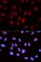 5-Aminoimidazole-4-Carboxamide Ribonucleotide Formyltransferase/IMP Cyclohydrolase antibody, LS-C334140, Lifespan Biosciences, Immunofluorescence image 