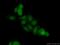Ligand Dependent Nuclear Receptor Corepressor antibody, 14476-1-AP, Proteintech Group, Immunofluorescence image 