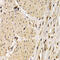 CD40 Molecule antibody, LS-C330843, Lifespan Biosciences, Immunohistochemistry paraffin image 