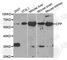 Complement Factor Properdin antibody, A5398, ABclonal Technology, Western Blot image 