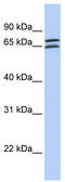 Decapping MRNA 1B antibody, TA339809, Origene, Western Blot image 