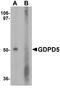 Glycerophosphodiester Phosphodiesterase Domain Containing 5 antibody, A10116, Boster Biological Technology, Western Blot image 