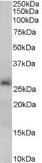 Sirtuin 3 antibody, PA5-18438, Invitrogen Antibodies, Western Blot image 