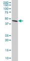 Adhesion Regulating Molecule 1 antibody, H00011047-M02, Novus Biologicals, Western Blot image 