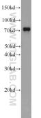 TBC1 Domain Family Member 17 antibody, 20482-1-AP, Proteintech Group, Western Blot image 