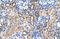 Solute Carrier Family 46 Member 3 antibody, ARP44158_T100, Aviva Systems Biology, Immunohistochemistry paraffin image 