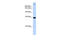 Trinucleotide Repeat Containing Adaptor 6A antibody, ARP40956_P050, Aviva Systems Biology, Western Blot image 