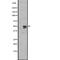 G Protein-Coupled Receptor 12 antibody, abx147559, Abbexa, Western Blot image 