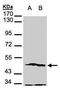 Phosphoglycerate Kinase 2 antibody, GTX107837, GeneTex, Western Blot image 