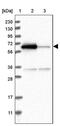 Acyl-CoA Synthetase Family Member 2 antibody, PA5-55156, Invitrogen Antibodies, Western Blot image 