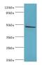 Hyaluronidase 1 antibody, LS-C377569, Lifespan Biosciences, Western Blot image 