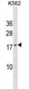  antibody, abx030682, Abbexa, Western Blot image 