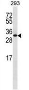 Charged Multivesicular Body Protein 6 antibody, AP50899PU-N, Origene, Western Blot image 