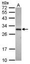 Alcohol Dehydrogenase Iron Containing 1 antibody, PA5-31415, Invitrogen Antibodies, Western Blot image 