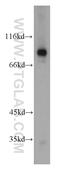 Transglutaminase 1 antibody, 12912-3-AP, Proteintech Group, Western Blot image 
