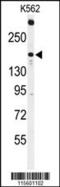 Activated CDC42 kinase 1 antibody, MBS9203747, MyBioSource, Western Blot image 