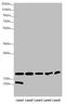 NADH:Ubiquinone Oxidoreductase Subunit A12 antibody, LS-C676129, Lifespan Biosciences, Western Blot image 