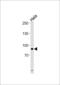Ubiquitin Like With PHD And Ring Finger Domains 1 antibody, 63-668, ProSci, Western Blot image 