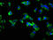 Interleukin 22 Receptor Subunit Alpha 1 antibody, LS-C371698, Lifespan Biosciences, Immunofluorescence image 