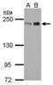 Zinc Finger E-Box Binding Homeobox 1 antibody, PA5-28221, Invitrogen Antibodies, Western Blot image 