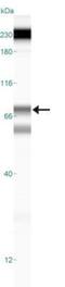 Arachidonate 5-Lipoxygenase antibody, NB110-58749, Novus Biologicals, Western Blot image 