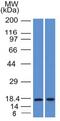 Prolactin Induced Protein antibody, GTX34753, GeneTex, Western Blot image 