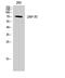 Zeta Chain Of T Cell Receptor Associated Protein Kinase 70 antibody, STJ96297, St John