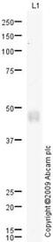 Galactosidase Alpha antibody, ab70520, Abcam, Western Blot image 