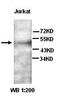 DEAD-Box Helicase 6 antibody, orb77298, Biorbyt, Western Blot image 