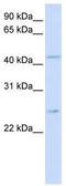 Glucose-6-phosphate translocase antibody, TA334059, Origene, Western Blot image 