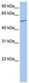 UDP Glucuronosyltransferase Family 2 Member A3 antibody, TA338673, Origene, Western Blot image 