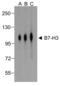 CD276 Molecule antibody, RF16092, ProSci Inc, Western Blot image 