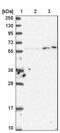 Karyopherin Subunit Alpha 3 antibody, NBP2-14172, Novus Biologicals, Western Blot image 