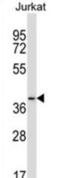 Progestin And AdipoQ Receptor Family Member 6 antibody, abx027526, Abbexa, Western Blot image 