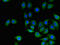 CD151 Molecule (Raph Blood Group) antibody, CSB-PA004880LA01HU, Cusabio, Immunofluorescence image 