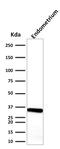 Calponin 1 antibody, GTX34451, GeneTex, Western Blot image 