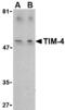 T Cell Immunoglobulin And Mucin Domain Containing 4 antibody, AHP1188, Bio-Rad (formerly AbD Serotec) , Western Blot image 