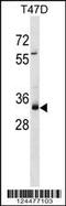 Myeloma Overexpressed antibody, 59-593, ProSci, Western Blot image 