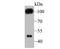 Gamma-Aminobutyric Acid Type B Receptor Subunit 2 antibody, A03830-1, Boster Biological Technology, Western Blot image 