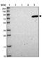 Propionyl-CoA Carboxylase Subunit Alpha antibody, NBP2-13736, Novus Biologicals, Western Blot image 