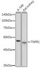 TNF Receptor Superfamily Member 1A antibody, GTX33550, GeneTex, Western Blot image 