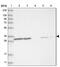 Voltage Dependent Anion Channel 1 antibody, NBP2-38163, Novus Biologicals, Western Blot image 