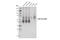 NAT2 antibody, 36057S, Cell Signaling Technology, Western Blot image 