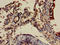 FGR Proto-Oncogene, Src Family Tyrosine Kinase antibody, LS-C677948, Lifespan Biosciences, Immunohistochemistry paraffin image 