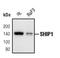 Inositol Polyphosphate-5-Phosphatase D antibody, PA5-17392, Invitrogen Antibodies, Western Blot image 