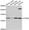 ATPase Plasma Membrane Ca2+ Transporting 2 antibody, abx006845, Abbexa, Western Blot image 