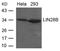 Lin-28 Homolog B antibody, PA5-49685, Invitrogen Antibodies, Western Blot image 