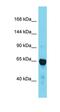 Transforming Acidic Coiled-Coil Containing Protein 2 antibody, orb331156, Biorbyt, Western Blot image 