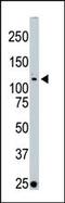 Serine/Threonine Kinase 10 antibody, 63-307, ProSci, Western Blot image 